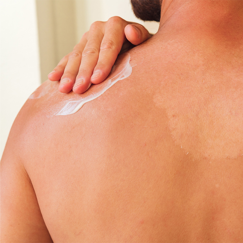 woman moisturizing her shoulder